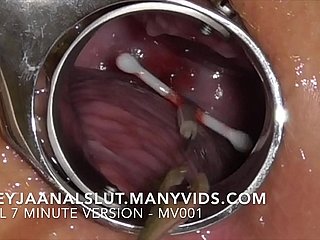Amatorskie FreyjaanalsLut: Usuwanie jej IUD - wyciągając go z szyjki macicy Freyji, dzięki czemu jest płodna ponownie - pełna wersja na Maturevidach